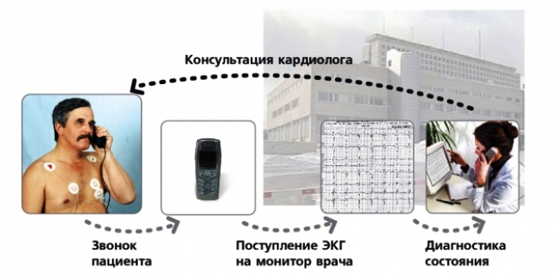 Схема транстелефонного контроля ЭКГ