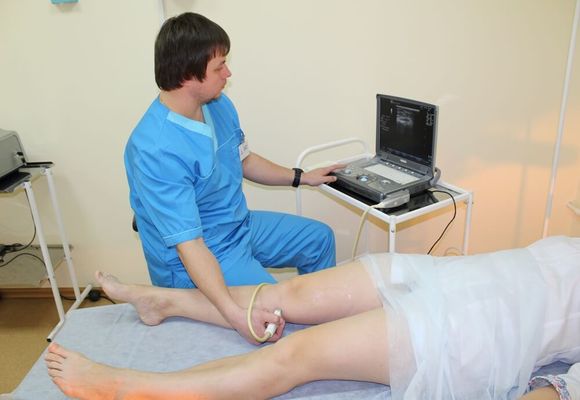 Сканирование варикоза нижних конечностей