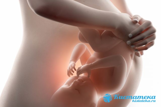 Чаще всего ретроцеребеллярная киста формируется из-за нарушений внутриутробного развития или появляется вследствие сложны родов
