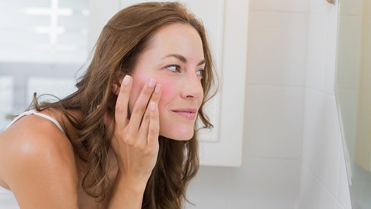 Аллергия на щеках у женщин thumbnail