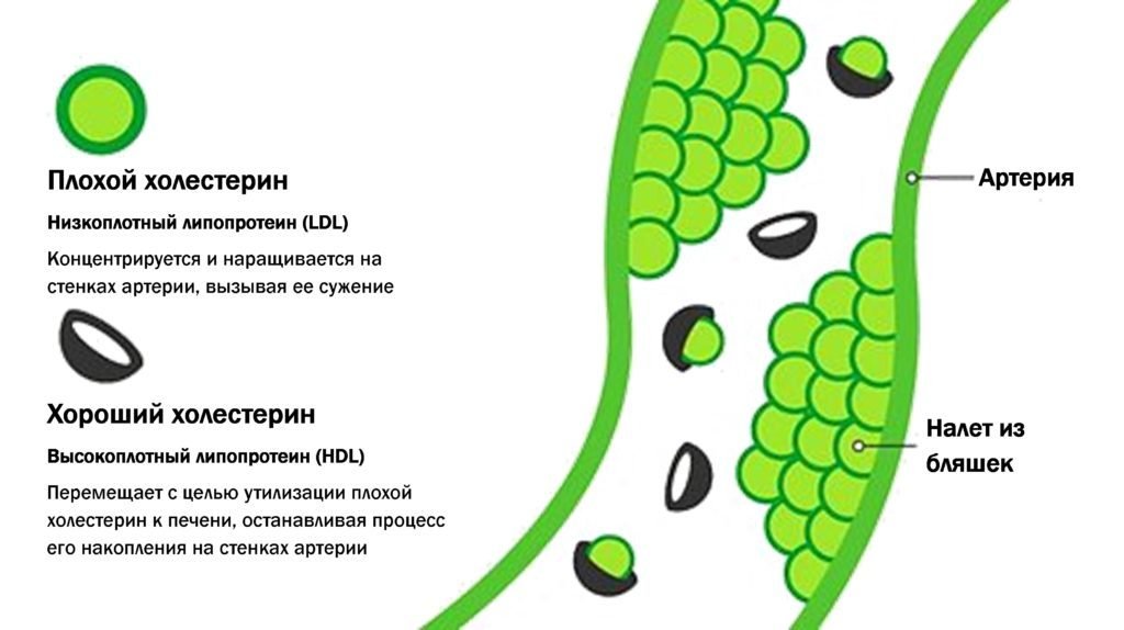 Повышение холестерина высокой плотности. Холестерин. Плохой холестерин. Хороший холестерин. Хороший и плохой холестерол.