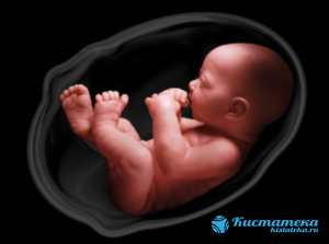 Нарушения в период эмбрионального развития