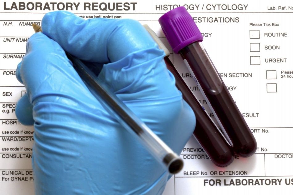 Чтобы избежать низкого и высокого уровня липопротеидов в крови необходимо периодически проходить обследование в лабораториях