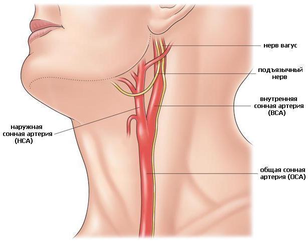 Брахиоцефальные артерии на шее 