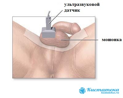 С помощью изображения на экране монитора врач легко определяет размеры яичек и полости