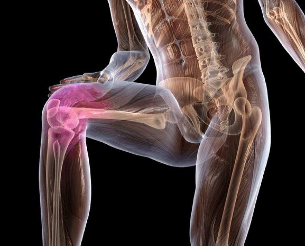 лечение остеохондроза коленного сустава