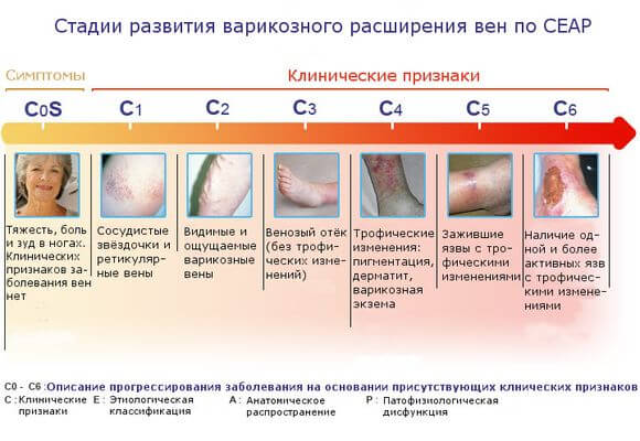 стадии развития в таблице