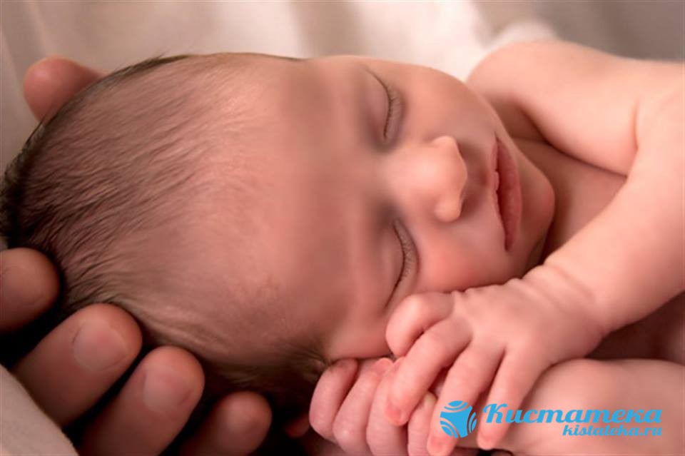 Доброкачественную опуоль выявляют в период проождения пренатального скрининга или после родов